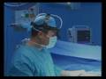 Αυξητική στήθους Live surgery!  3 Ν. Καποσίτας M.D,PhD,Greece