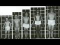 Anomalias Cromossômicas