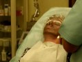 Peeling laserowy węglowy - scar laser treatment