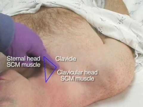 how to locate jugular vein