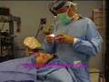 Designer Nose: Natural Rhinoplasty (nose Job)