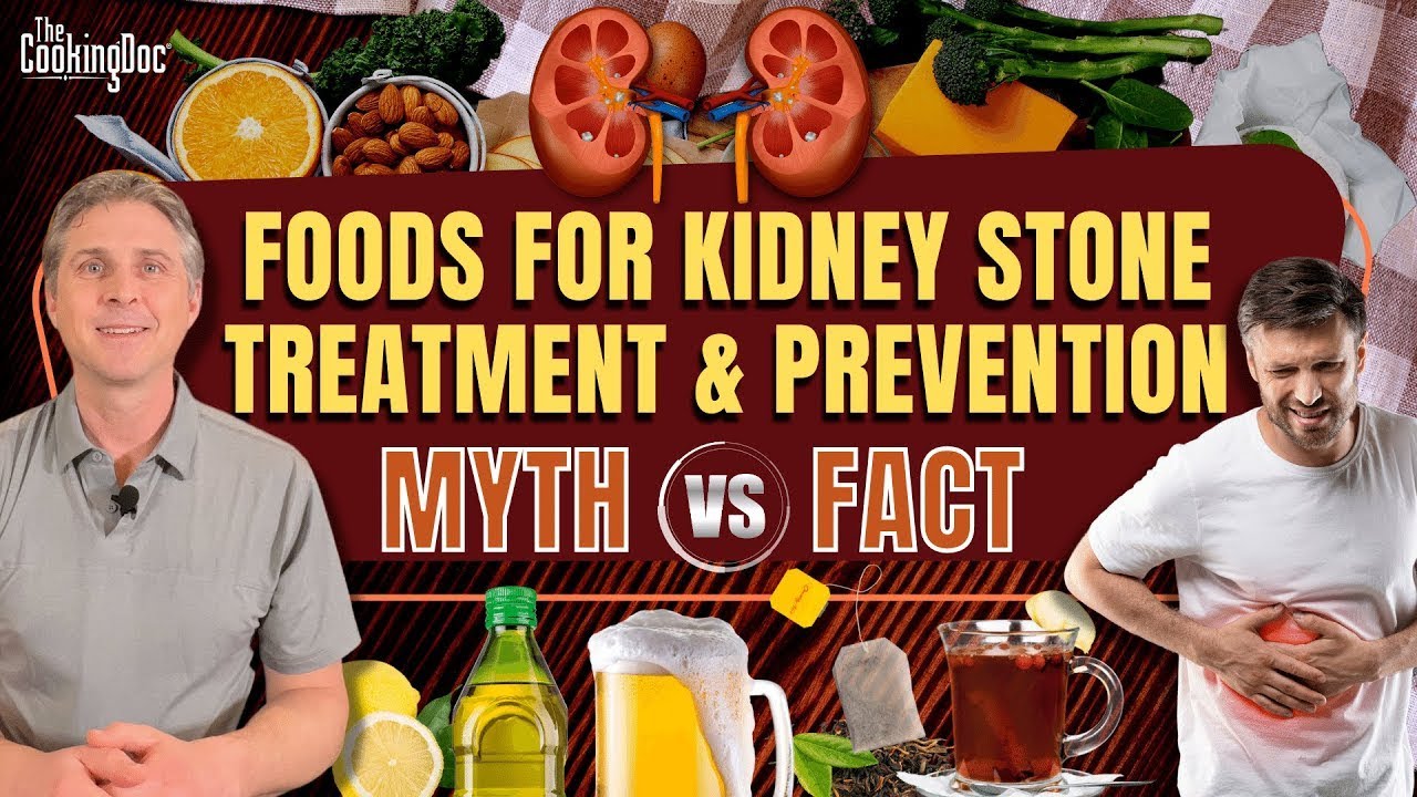 Foods for Kidney Stone Treatment and Prevention | Myth vs Fact | The Cooking Doc®