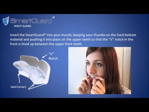 how to whiten night guard
