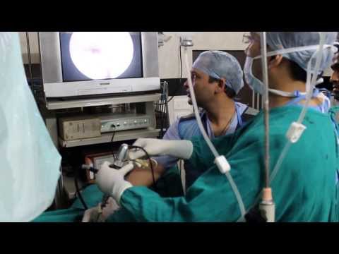 how to remove dj stent