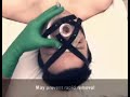 mechanical ventilation 1