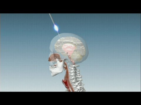 how to rebuild dopamine levels