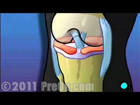 how to repair knees