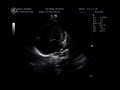 Echocardiography Marcel Snyman Echocardiography Marcel Snyman