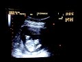 ac� se ve la cara de frente: los ojos, la nariz, la boca... parece un extraterrestre!