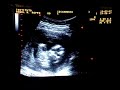ac� se ve la cara de frente: los ojos, la nariz, la boca... parece un extraterrestre!