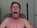 Dystonia Facial Spasms