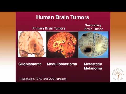 Thomas Seyfried, PhD — Targeting Energy Metabolism in Brain Cancer