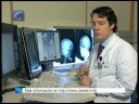 Medicina / Investigación: Un procedimiento pionero mediante braquiterapia evita que la vena cava vuelva a ocluirse
