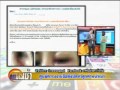 ฉีดจมูกเน่า วุฒิศักดิ์ ระวังภัย - YouTube