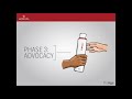 See Video