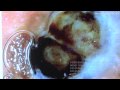 Automatic diagnosis system for malignant melanoma using the Internet : DigInfo