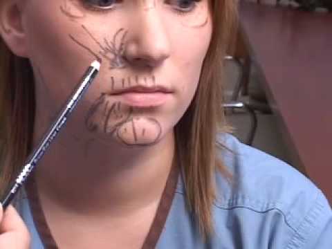 facial diagram
