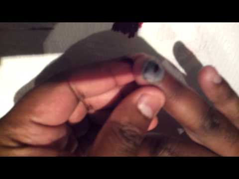 how to relieve burns