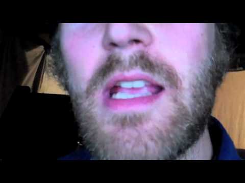 Watch This video Watch This video
