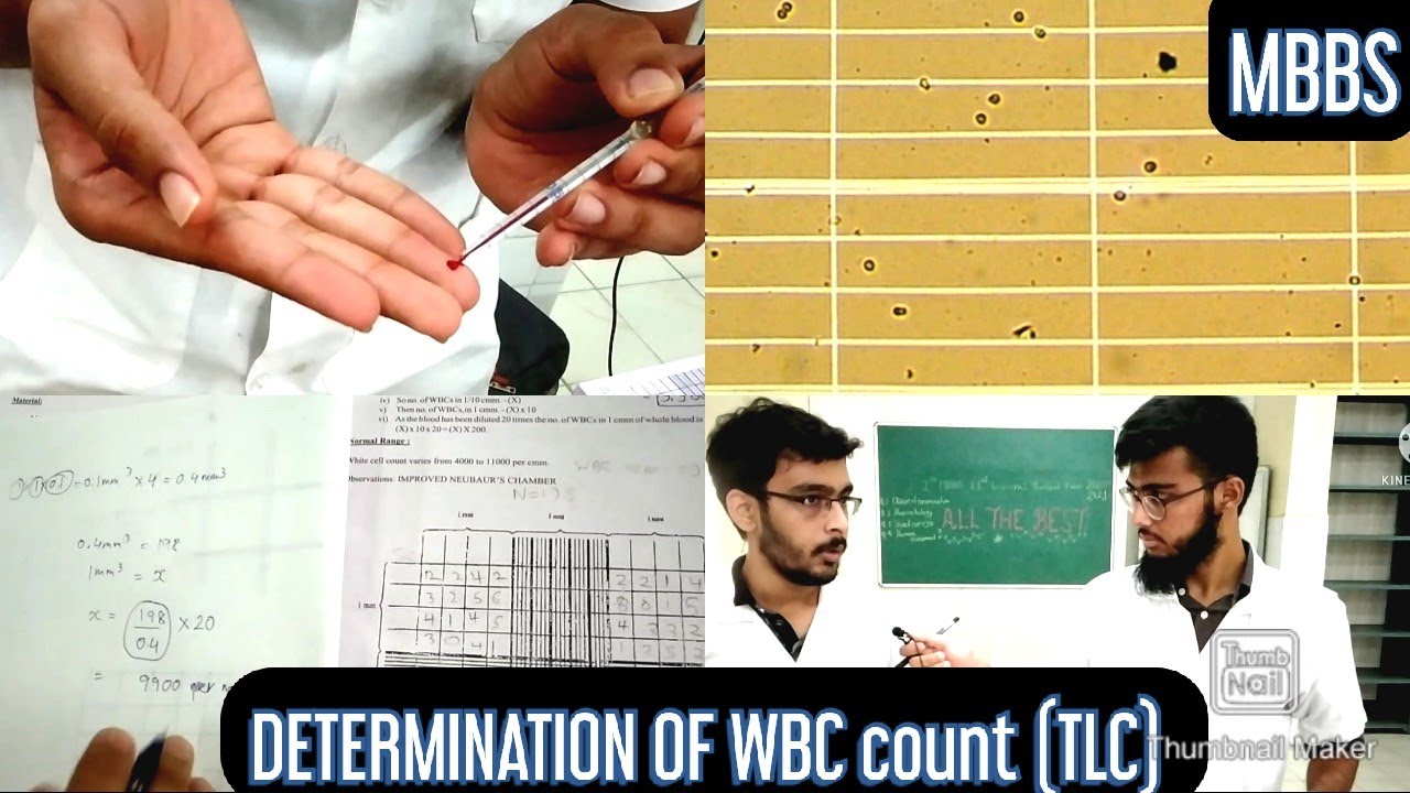 Determination of WBC count (TLC -Total leucocyte count) | MUHS | #mbbs #practical #hematology