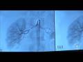 Imaging is Everything - MyRegence.com