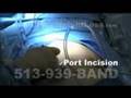 Live Surgery: Cincinnati Laparoscopic Adjustable Gastric Banding