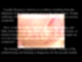 Rosacea