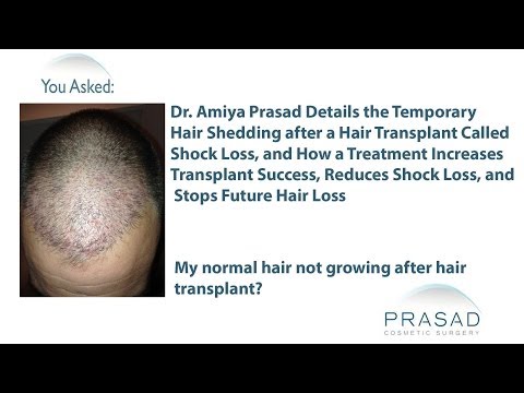 how to prevent transplant shock
