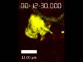 A dermal dendrite cell containing multiple vacuoles capturing an Leishmania parasite