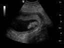 baby gareth3