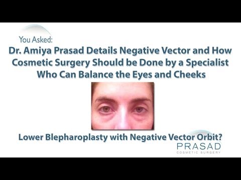 how to balance a vector