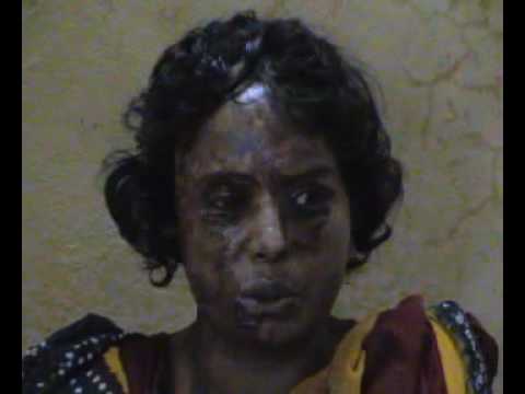 See video