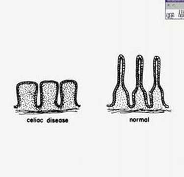 Histopathology Small ...
