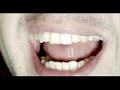Fly Project K-Tine Teezeer