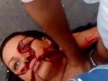 Neda murdered by coward Baseej in Iran. WARNING: GRAPHIC: (alretnate video)