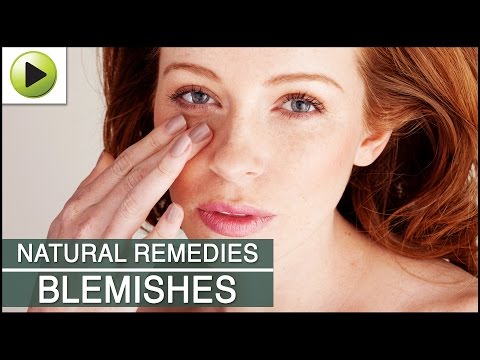 how to de skin almonds
