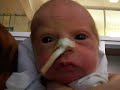 DaX alekzander young funny face DaX alekzander young funny face
