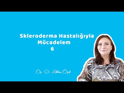 Skleroderma Hastalığıyla Mücadelem 6 - Op. Dr. Akben Özel - 2021.02.26