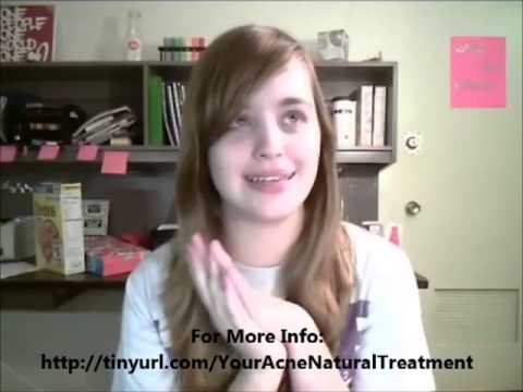 how to cure oily skin permanently