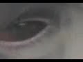 selston black eye