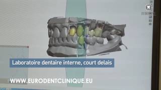 Eurodent fogászat francia nyelven