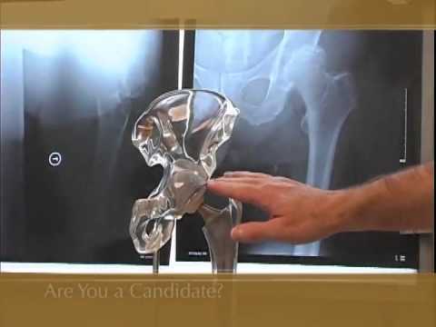 how to decide when to have a knee replacement