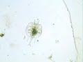 Rotifer, Platyias leloupi.wmv