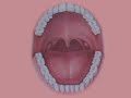 Laser Dental Cleaning Laser Dental Cleaning
