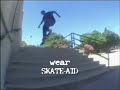 SKATE-AID (bucks story part 1)