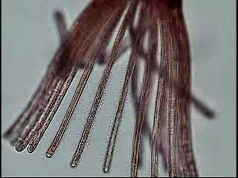 Bryozoan feeding