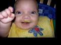 Owen 6-12 months (spina bifida) (cleft lip & palate)