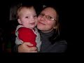 Owen 6-12 months (spina bifida) (cleft lip & palate)