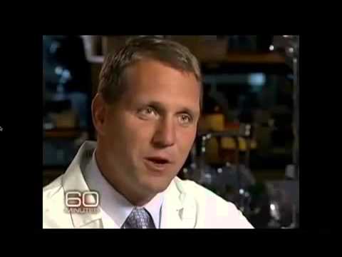 Resveratrol Select - Miraculous anti-aging and weight loss properties
