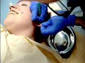 dermal punch